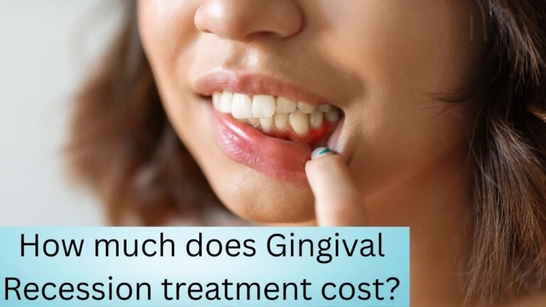 How much does Gingival Recession treatment cost?