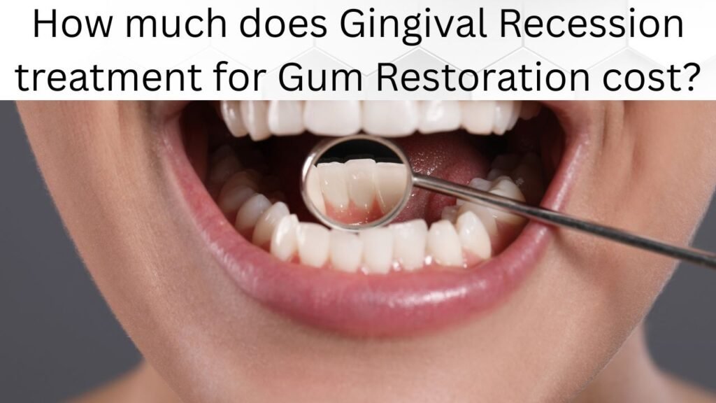 How much does Gingival Recession treatment for Gum Restoration cost How much does Gingival Recession treatment for Gum Restoration cost?
