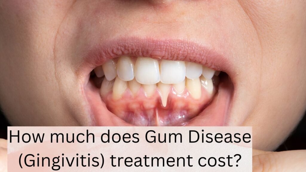 How much does Gum Disease (Gingivitis) treatment cost How much does Gum Disease (Gingivitis) treatment cost?