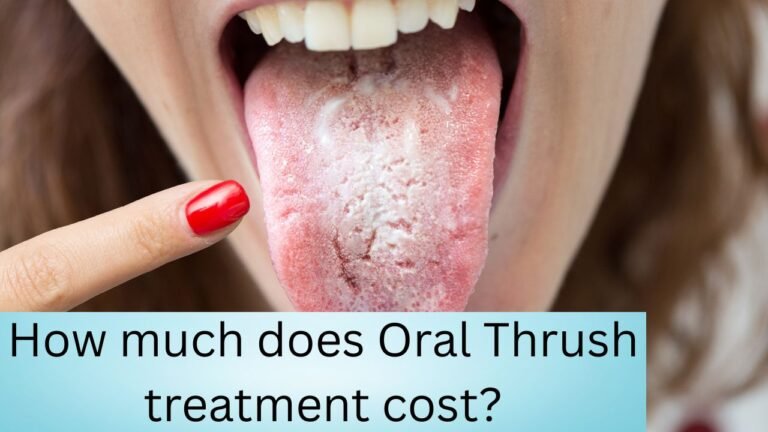 How much does Oral Thrush treatment cost?