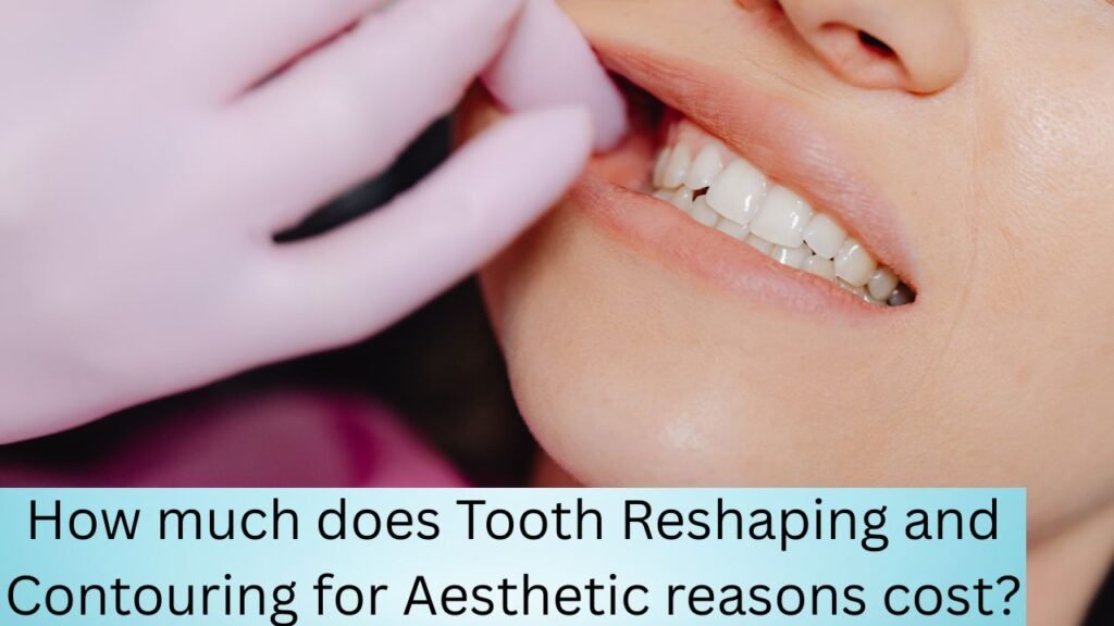 How much does Tooth Reshaping and Contouring for Aesthetic reasons cost How much does Tooth Reshaping and Contouring for Aesthetic reasons cost?