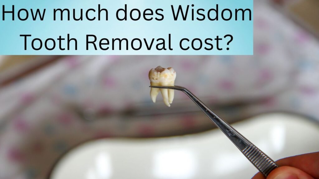How much does Wisdom Tooth Removal cost How much does Wisdom Tooth Removal cost?