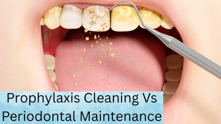 Prophylaxis Cleaning Vs Periodontal Maintenance