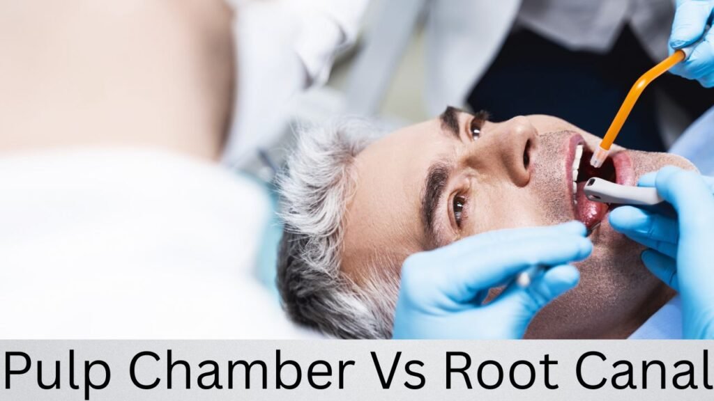 Pulp Chamber Vs Root Canal Pulp Chamber Vs Root Canal