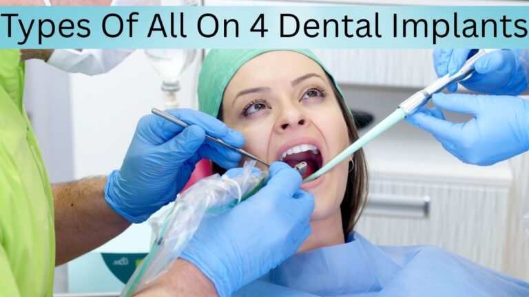 Types Of All On 4 Dental Implants