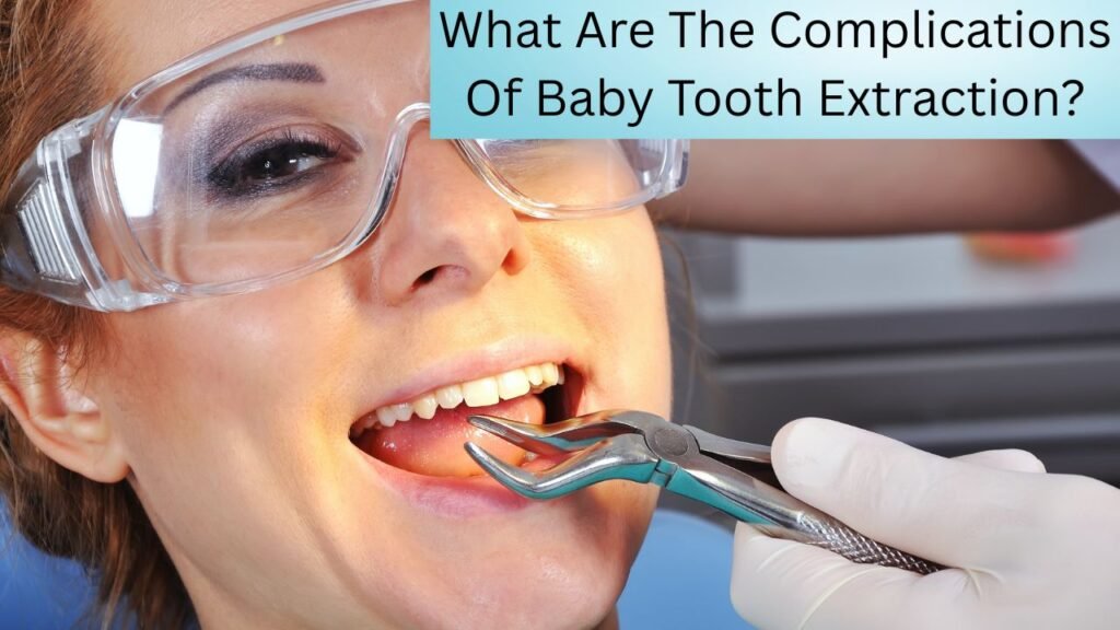 What Are The Complications Of Baby Tooth Extraction What Are The Complications Of Baby Tooth Extraction?