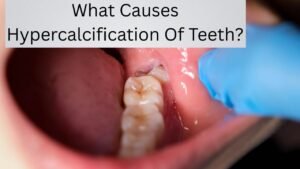 What Causes Hypercalcification Of Teeth?