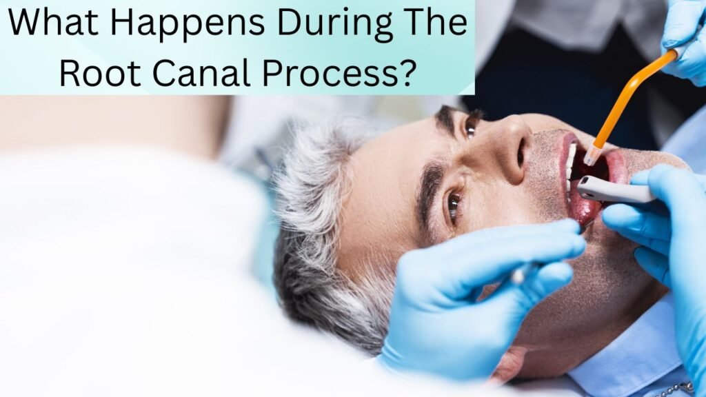 What Happens During The Root Canal Process What Happens During The Root Canal Process?