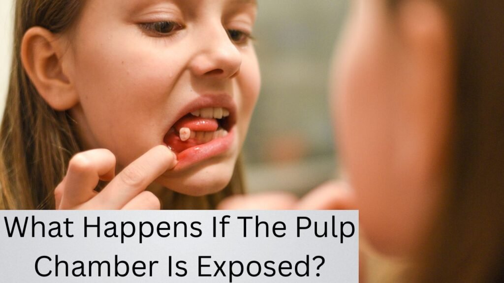 What Happens If The Pulp Chamber Is Exposed What Happens If The Pulp Chamber Is Exposed?