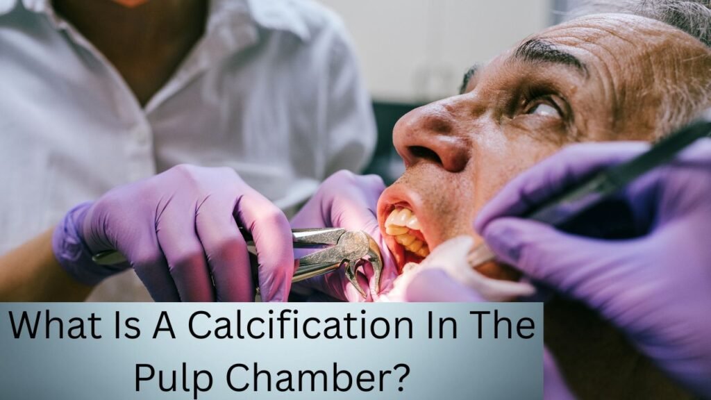 What Is A Calcification In The Pulp Chamber What Is A Calcification In The Pulp Chamber?
