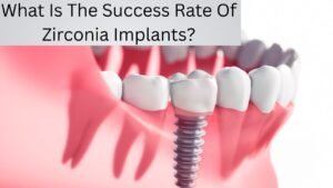 What Is The Success Rate Of Zirconia Implants?