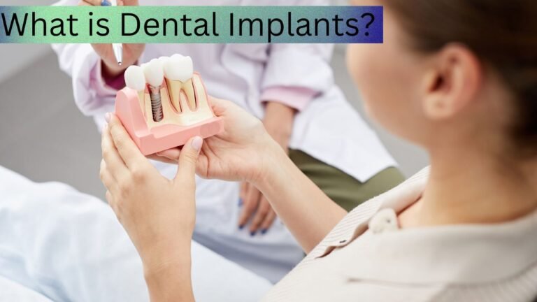 What is Dental Implants?